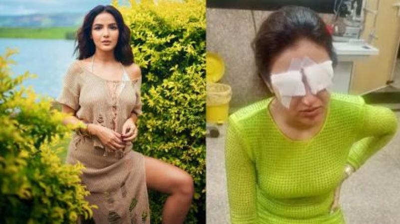 Jasmine Bhasin Faces Eye Injury Due to Contact Lenses