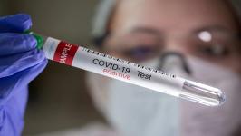 Amravati Reports Six COVID-19 Cases and One Swine Flu Case
								