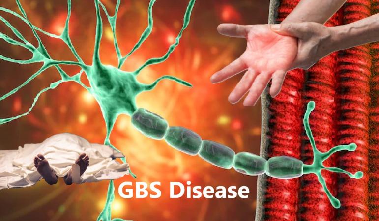 GBS Claims Another Life at GMC, Three Still Under Treatment